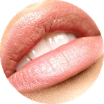 Lip Augmentation